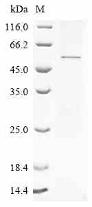 (Tris-Glycine gel) Discontinuous SDS-PAGE (reduced) with 5% enrichment gel and 15% separation gel. Boiling SDS-treated samples may result in membrane protein aggregation. Incubation at 37 centigrade for 10 min is an effective alternative.